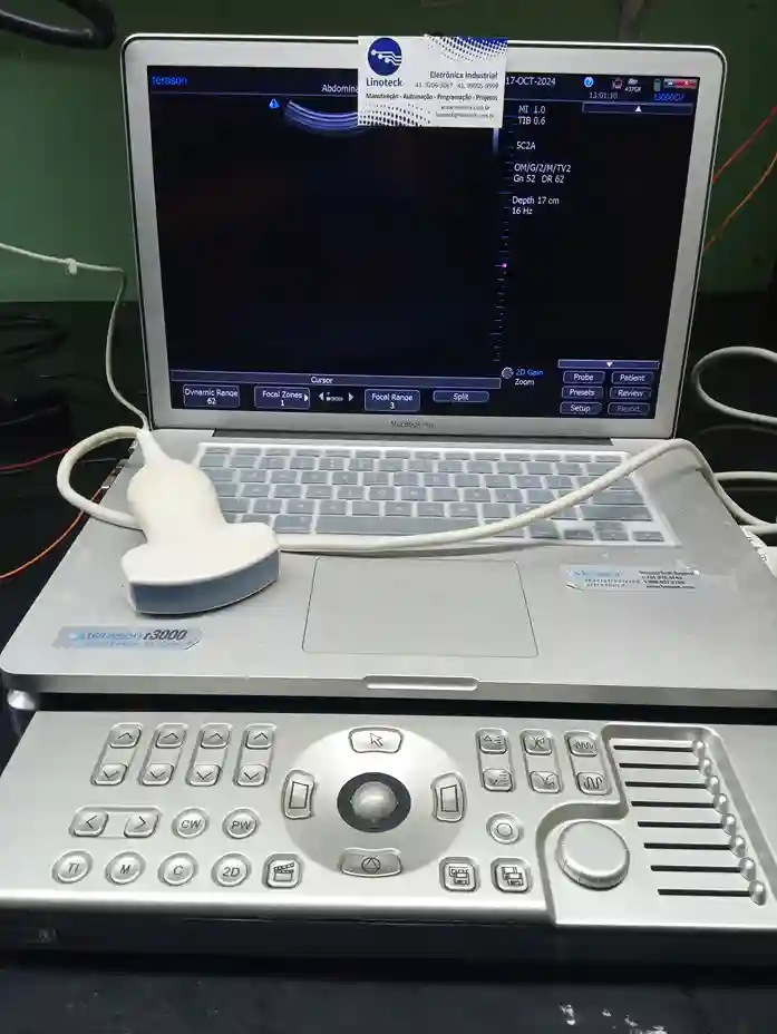 Assistência Técnica em Equipamento Ultrassonografia Terason t3000