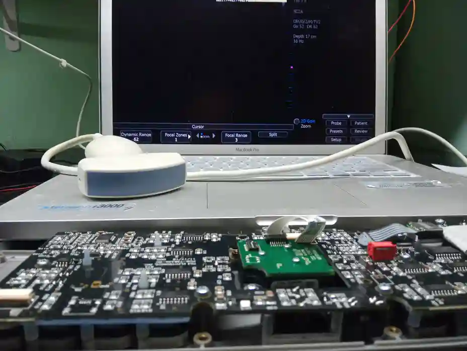 Assistência Técnica em Equipamento Ultrassonografia Terason t3000 Assistência Técnica em Equipamento Ultrassonografia Terason t3000