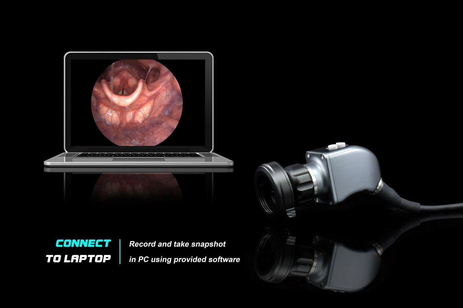 Reparo da Câmera de endoscopia portátil e fonte de luz ESC Medicams
endoscópio médico
Reparo da Câmera de endoscopia portátil e fonte de luz ESC Medicams
endoscópio médico
