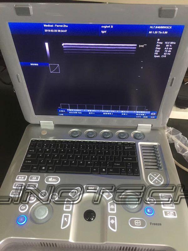 Conserto Manutenção Ultrassom Portátil
Conserto Manutenção Ultrassom Portátil